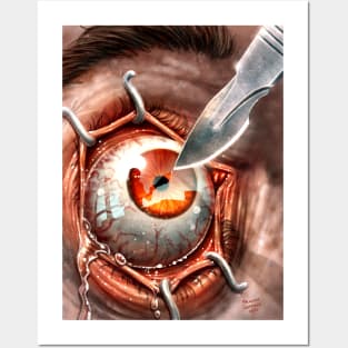 Eye Scalpel Nightmare Posters and Art